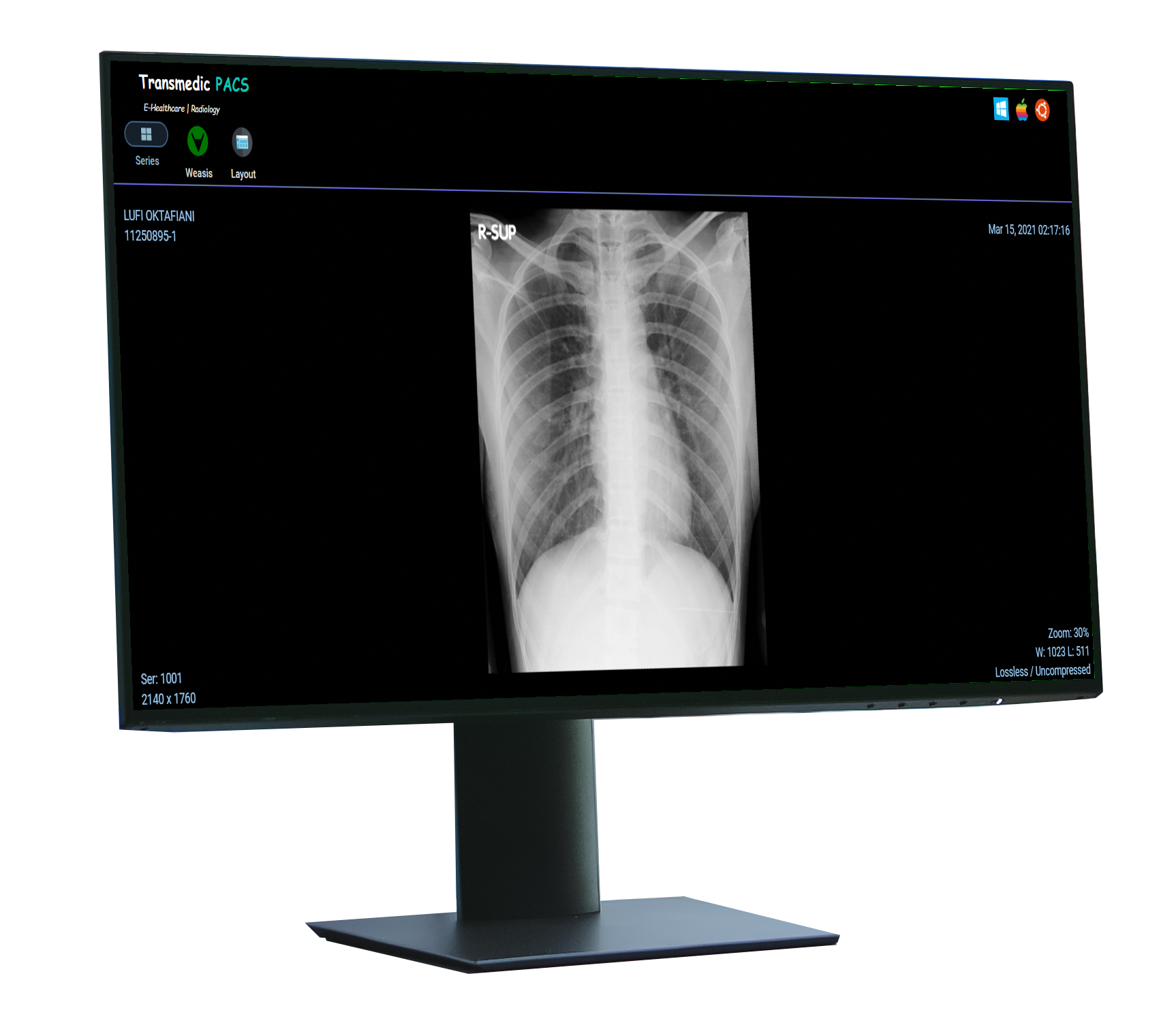 Picture Archiving & Communication System PACS